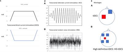 Brain Modulation by Electric Currents in Fibromyalgia: A Structured Review on Non-invasive Approach With Transcranial Electrical Stimulation